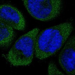 Dfna5 Antibody, Novus Biologicals:Antibodies:Primary Antibodies